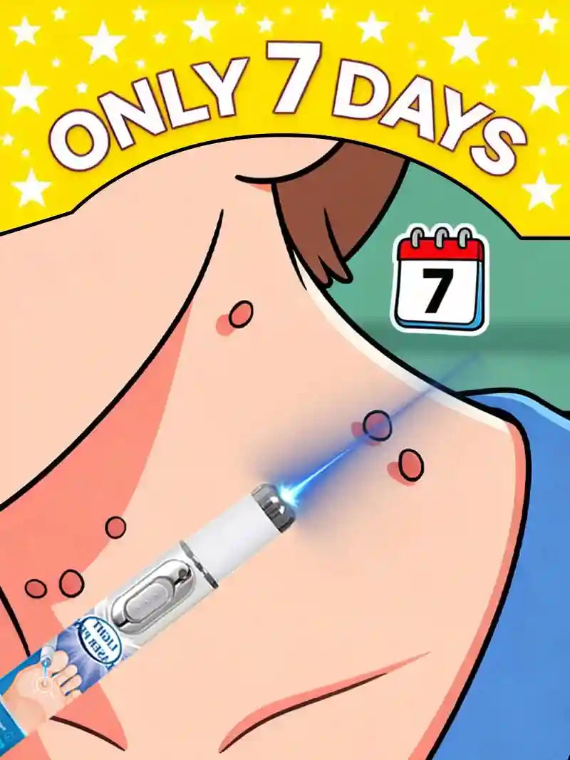 Blue Light Pen for Wart Removal – Certified Skin Care Tool Lip Care Tidesmit