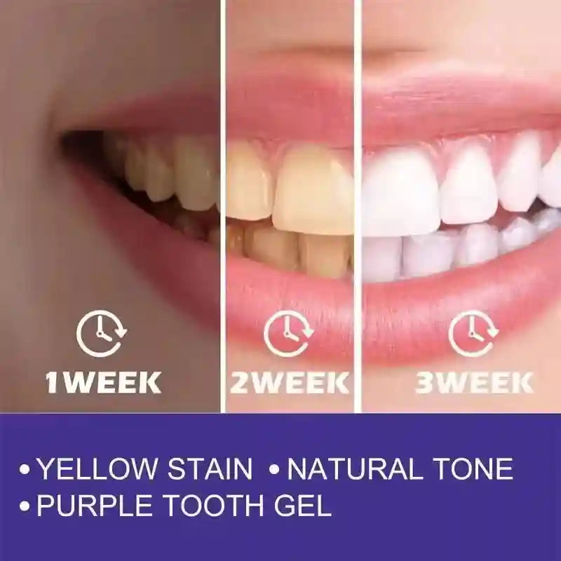 Tidesmit teeth whitening toothpaste and whitening stick for deep cleaning, stain removal, and fresh breath.