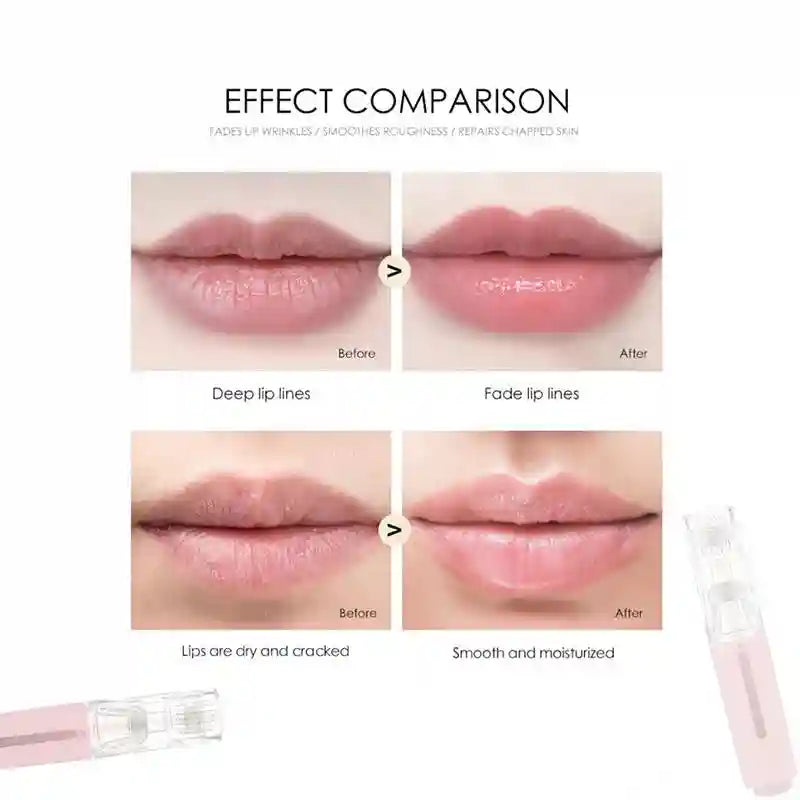 Before and after comparison of lips treated with a pink derma roller to reduce lip lines and dryness.
