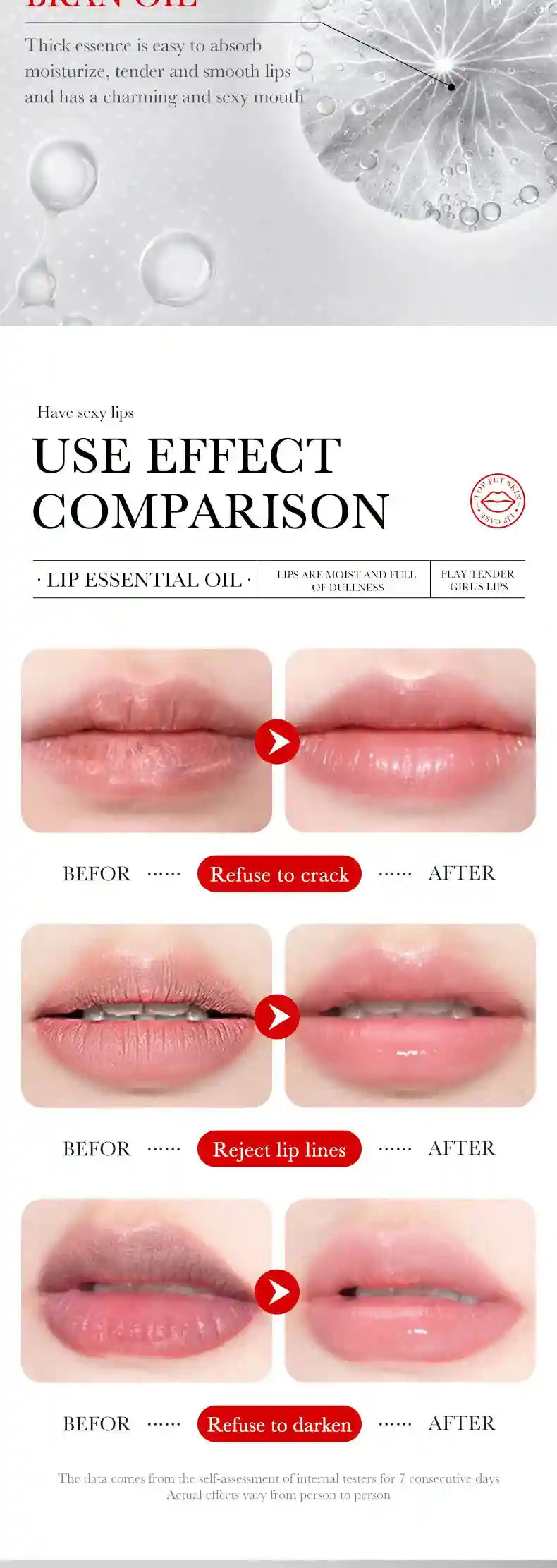 Lip Plumping Serum With Hyaluronic Acid - Hydrating Lip Treatment Lip Care Tidesmit