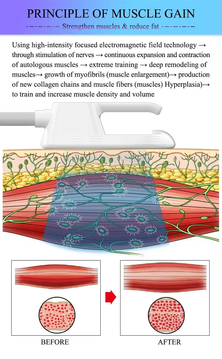 HIEMT EMS body sculpting machine diagram showing muscle gain, fat reduction, and fiber remodeling mechanism.