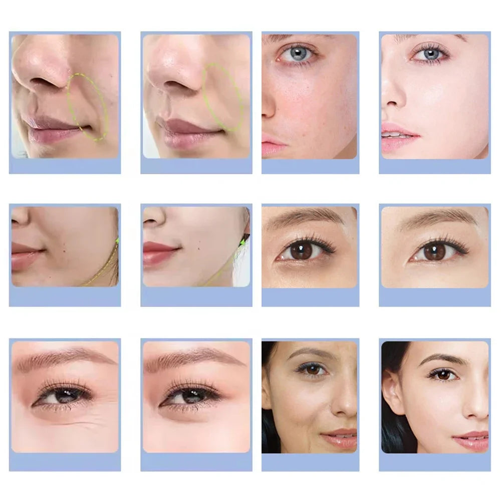 Before and after photos showing skin wrinkle reduction, facial smoothing, and dark circle treatment on different faces.