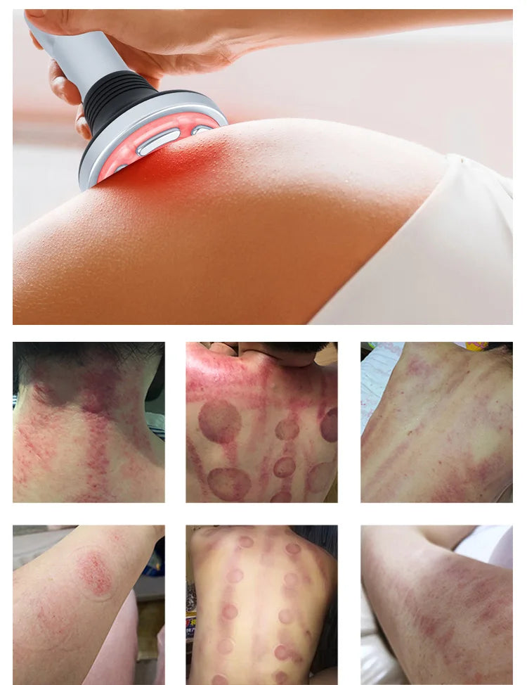 6-in-1 ultrasonic cavitation machine for RF skin tightening, body sculpting, and slimming therapy on skin and back.