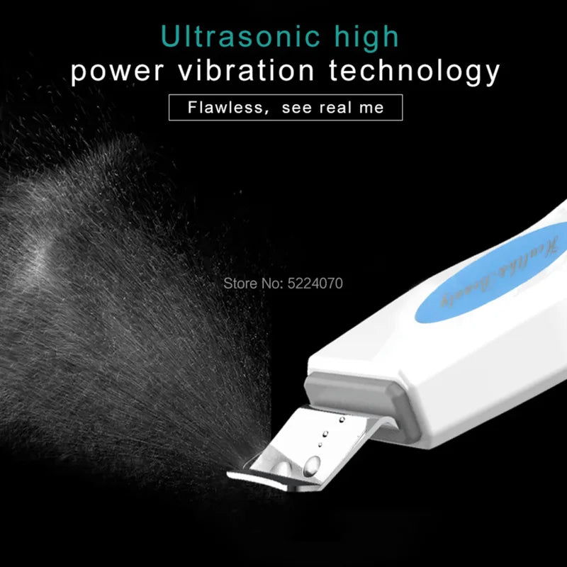 Ultrasonic Facial Skin Scrubber | Deep Pore Exfoliator & Spa Tool Scrubs Treatments Tidesmit