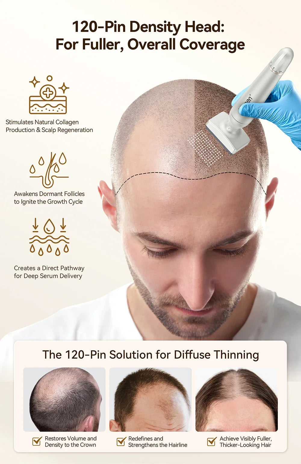 Adjustable microneedling pen for hair growth with 120-pin head for scalp rejuvenation and fuller hair density.