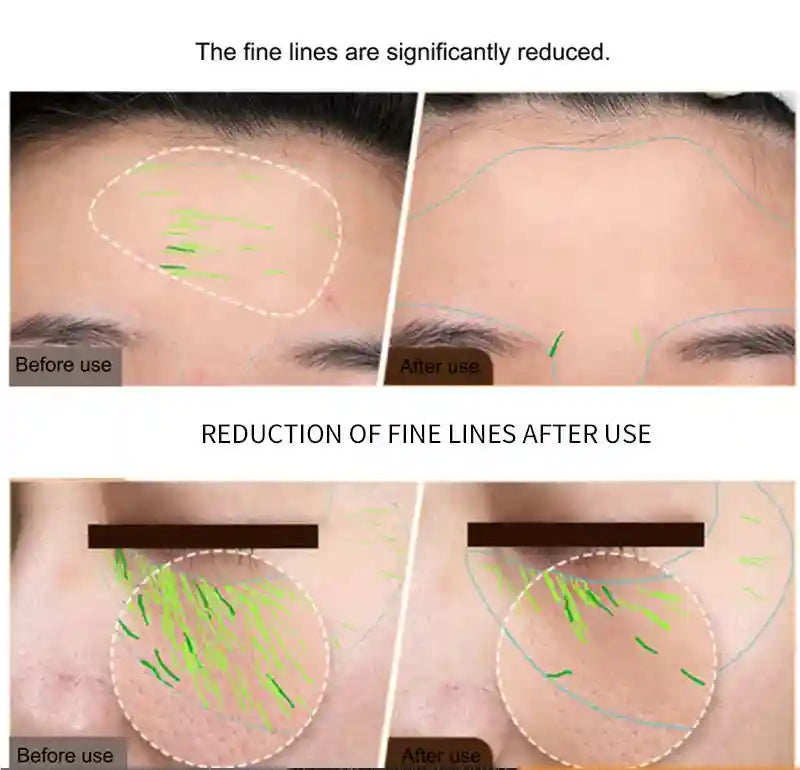 EMS Facial Lifting Device - Professional Skin Tightening & Toning Eye Massage Instrument Tidesmit