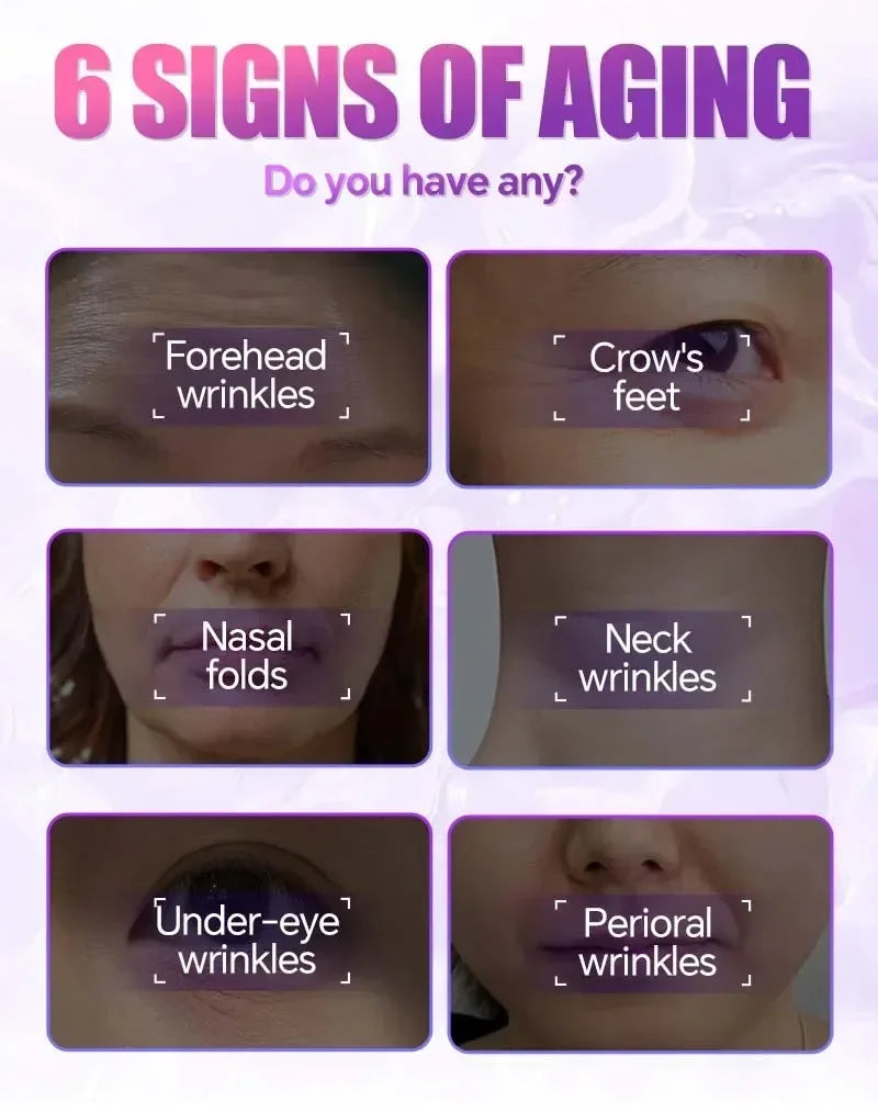 Educational infographic showing 6 signs of aging including forehead wrinkles, crow's feet, and neck skin sagging.