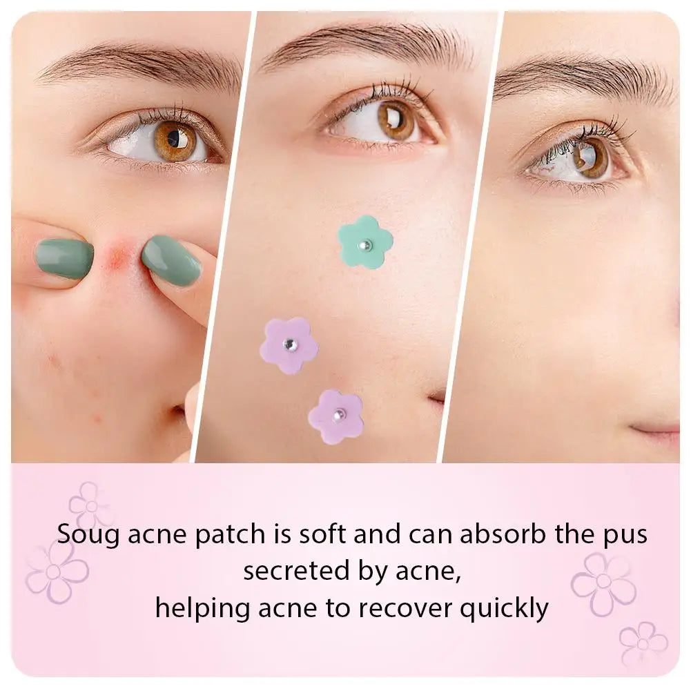 Tidesmit multicolored flower-shaped hydrogel acne patches with decorative pearl and diamond accents for spot care.