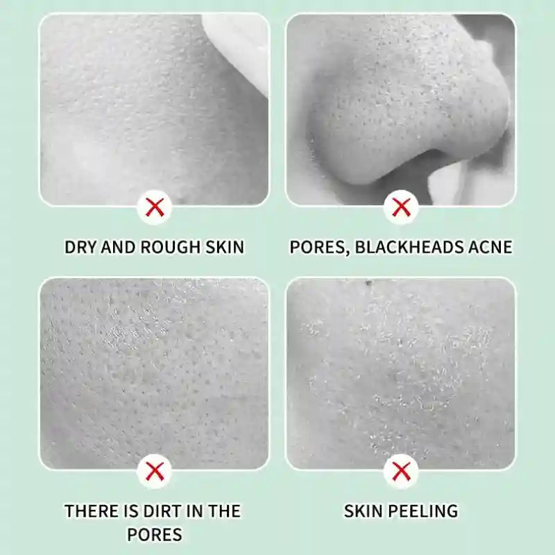 Herbal Exfoliating Gel Face Scrub: Natural Deep Cleansing Moisturizer Scrubs Treatments Tidesmit