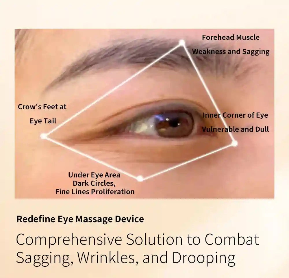 Microcurrent Eye Massager for Facial Lifting and Dark Circles Eye Massage Instrument Tidesmit
