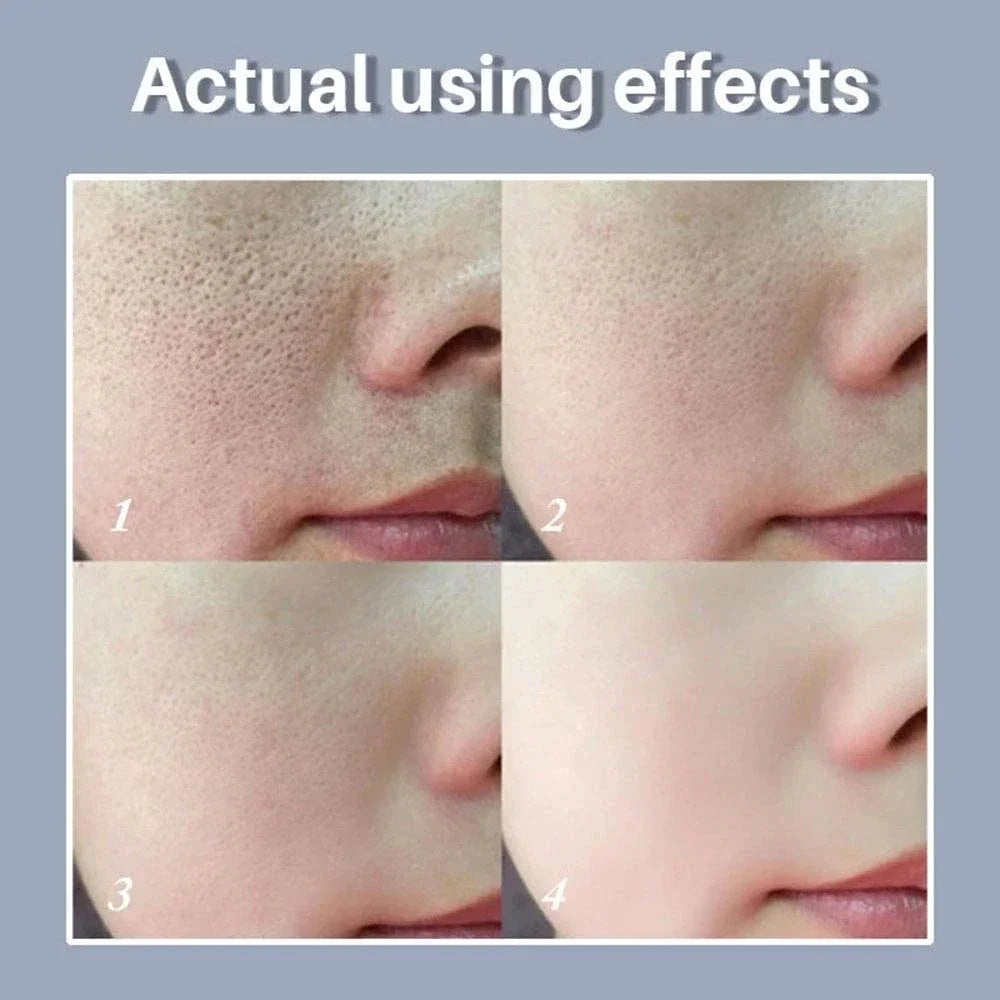 Retinol Niacinamide Serum - Professional PMU Machine Pore Refining Permanent Makeup Machines Tidesmit