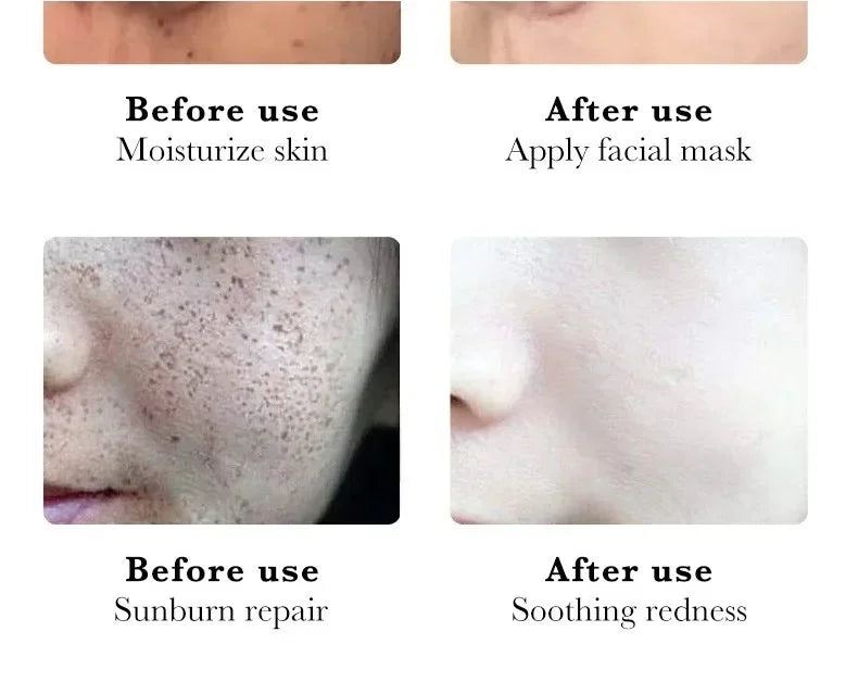 Tidesmit niacinamide melasma cream for dark spot correction and skin brightening in a moisturizing face care texture