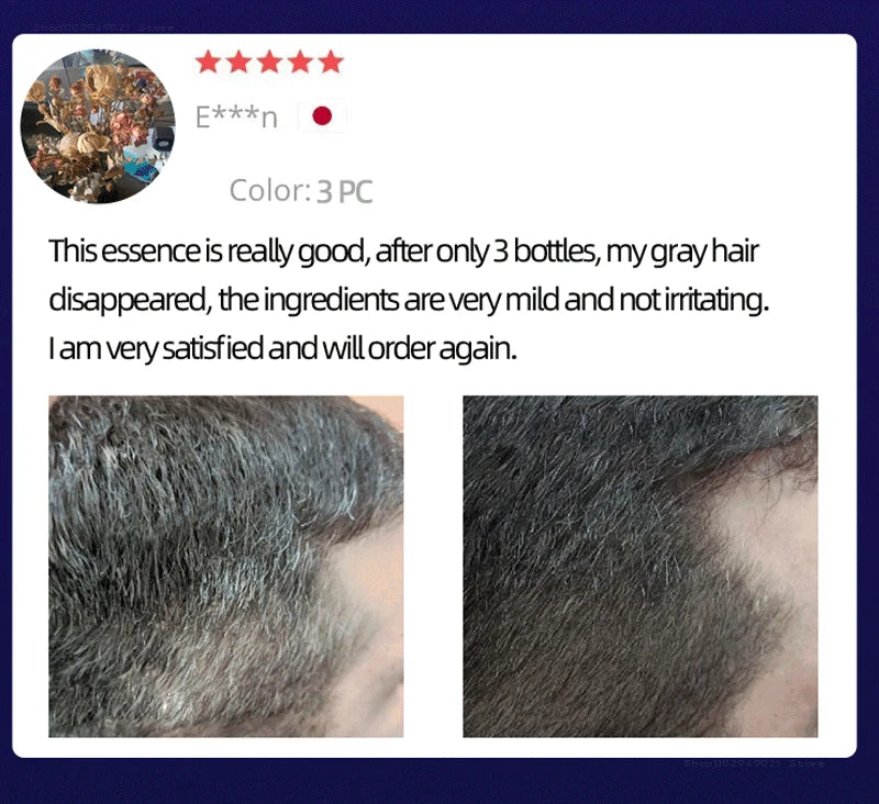 Anti Gray Hair Serum – Natural Scalp Nourishing Darkening Care Lip Care Tidesmit