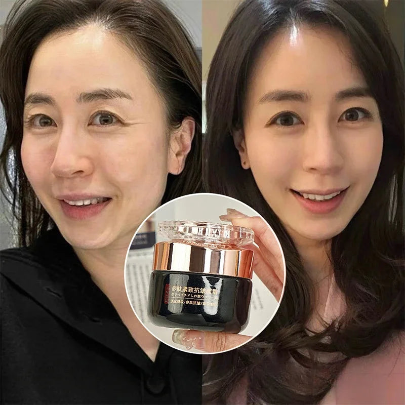 Anti-wrinkle face cream in a small black jar with a metallic gold lid, held by a woman showing skin improvement.