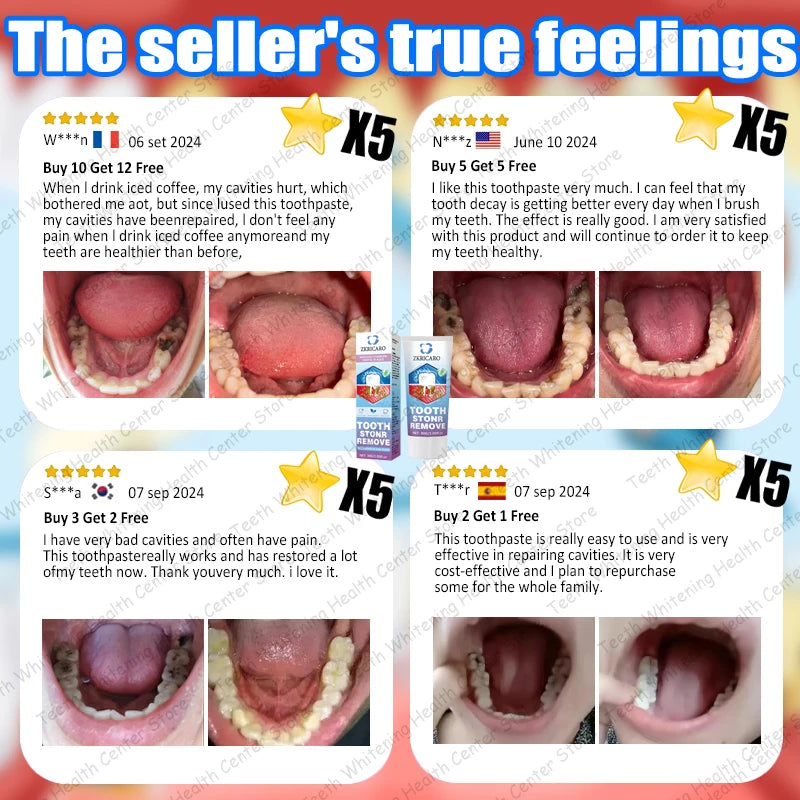 Teeth Whitening Scrub Paste | Deep Cleaning Dental Treatment Scrubs Treatments Tidesmit