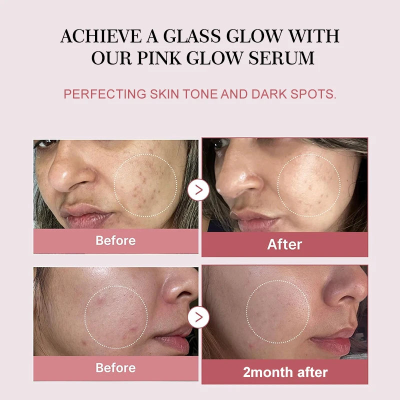 Collagen peptide facial serum before and after results showing improved skin texture, tone, and a radiant pink glow.