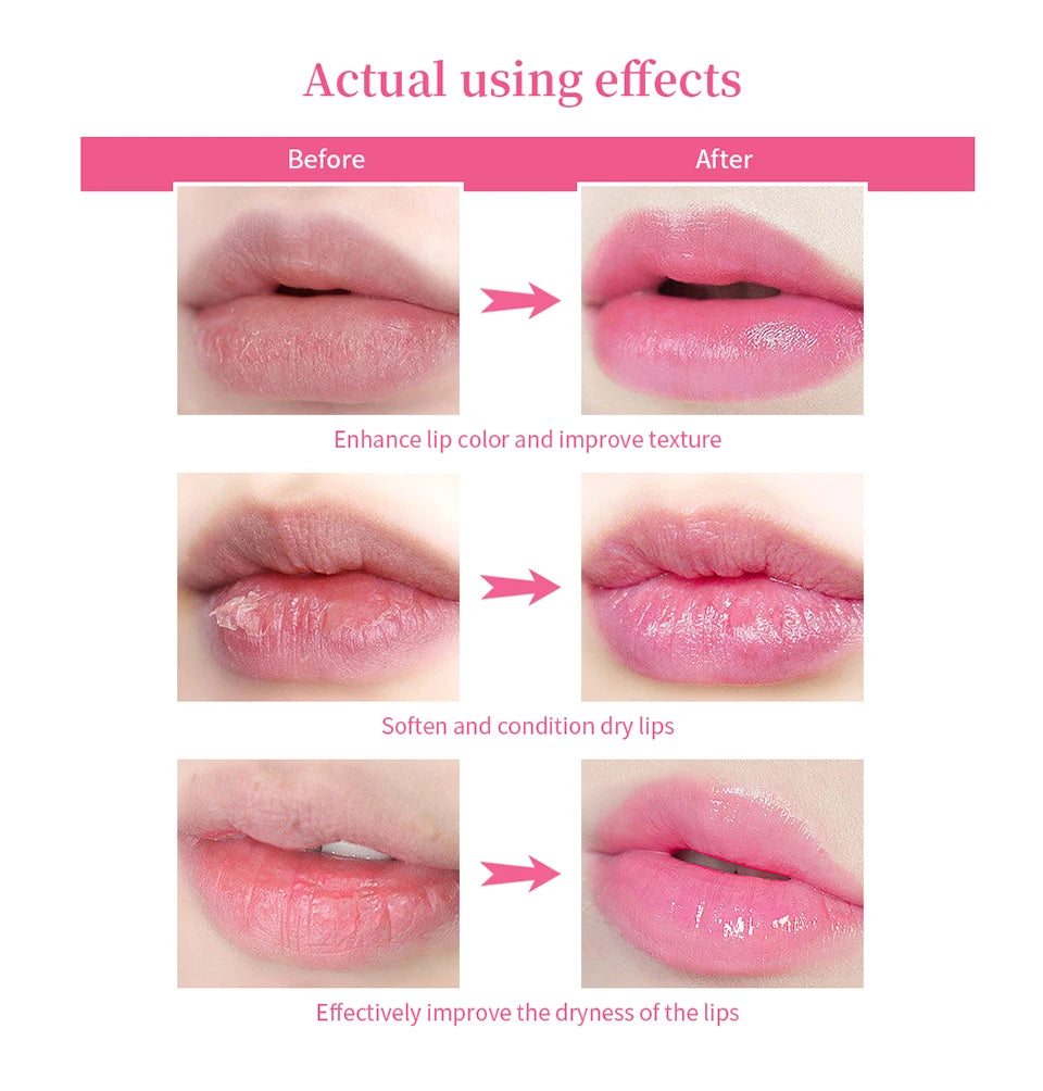 Lip Lightening Serum for Dark Lips - Hydrating Repair Treatment Lip Care Tidesmit
