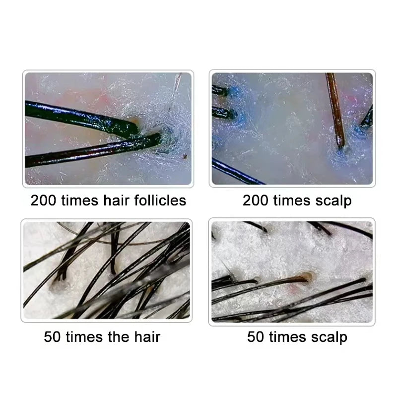 Microscopic views of hair and scalp at 50x and 200x magnification, showing hair follicles and strands on skin surface.