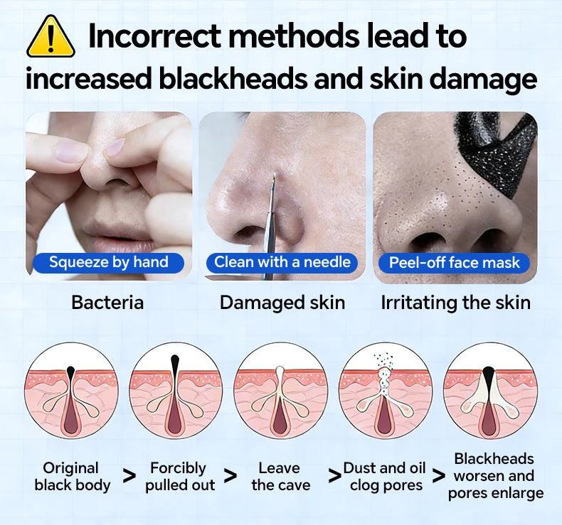 Infographic showing harmful blackhead removal methods versus electric pore vacuum cleaner benefits for clear skin.