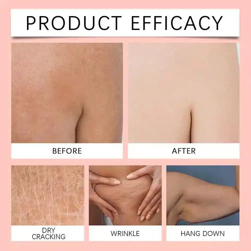 Before and after comparison of skin texture improvements for dry, wrinkled, or sagging skin on arms and body.