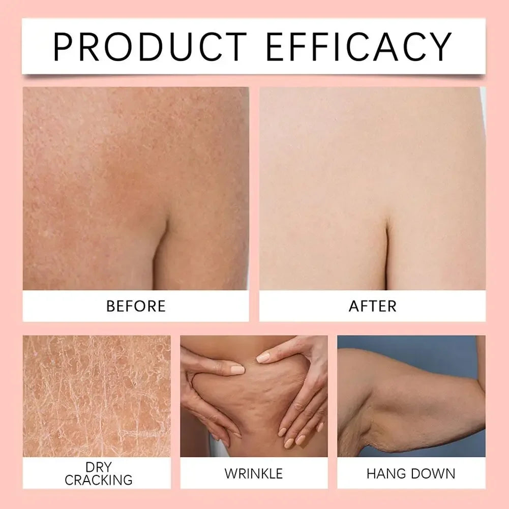 Skin treatment results showing improvements in dryness, wrinkles, and skin sagging on arms and body.