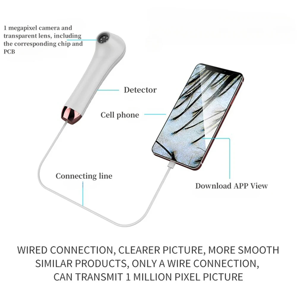 White HD scalp and hair follicle detector with wired connection to smartphone for professional skin and hair analysis.