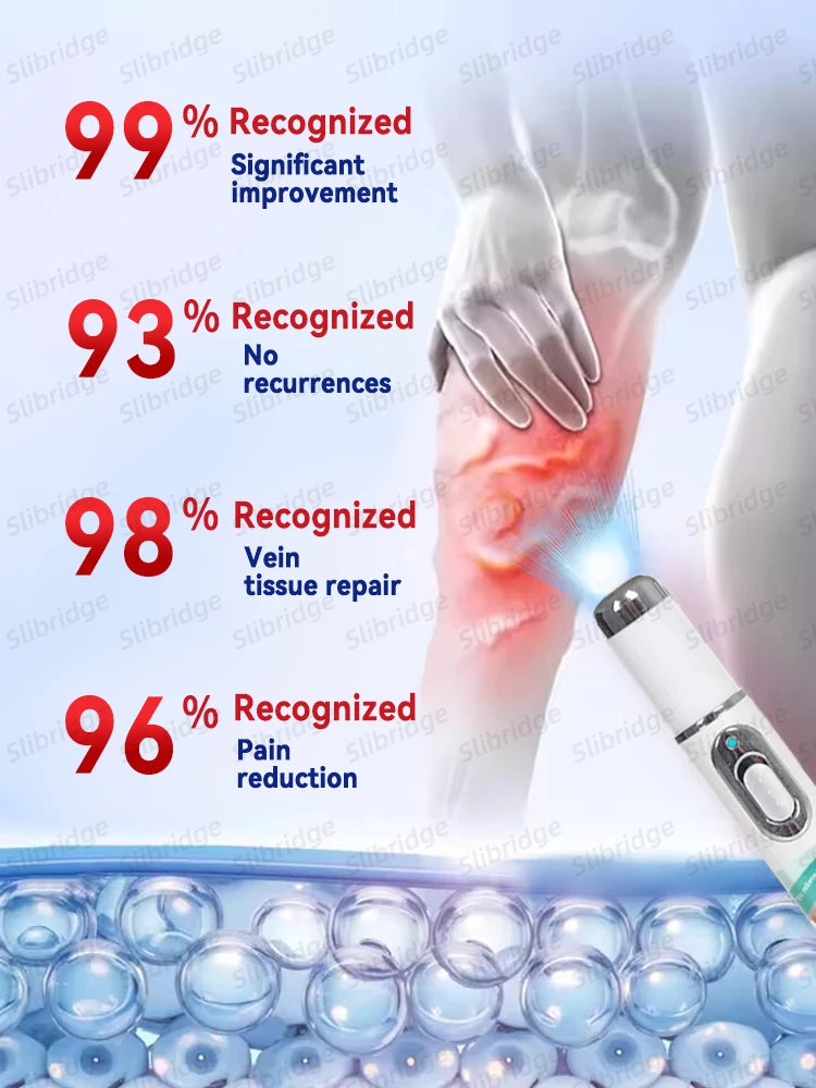 Portable blue laser device for painless varicose vein treatment, showing clinical repair results and improvement stats.