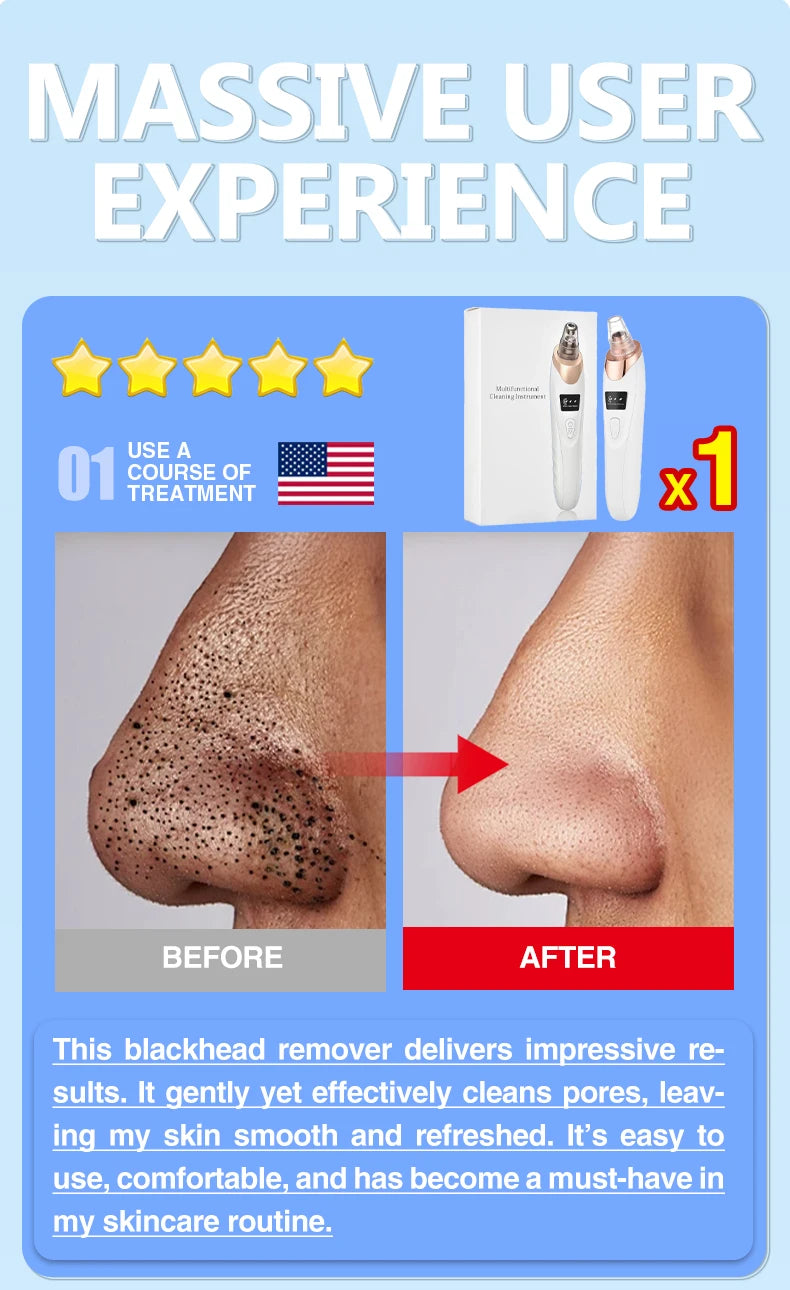 Electric blackhead remover vacuum pore cleaner showing before and after results for acne and facial skin cleansing.