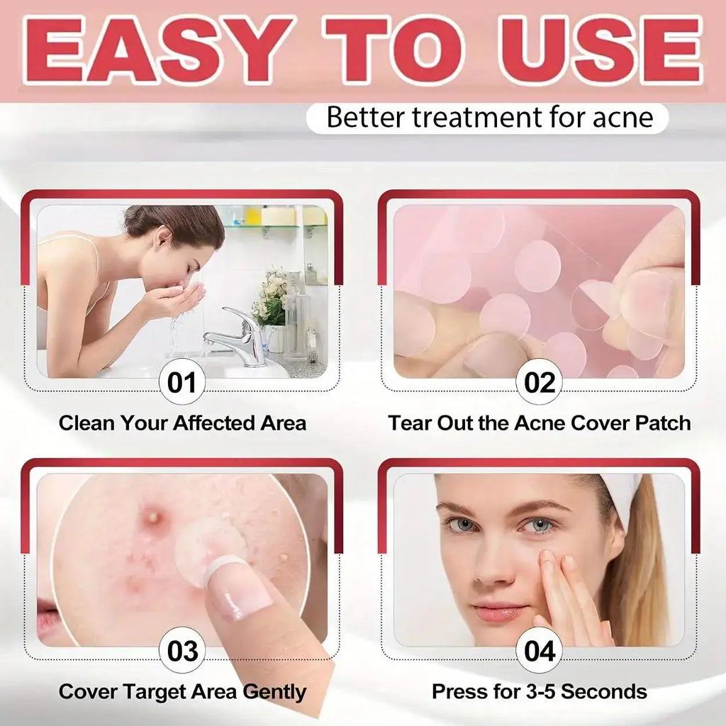 Tidesmit tea tree oil acne patch effectively removes pimples, alcohol-free and odorless, 6 of 13