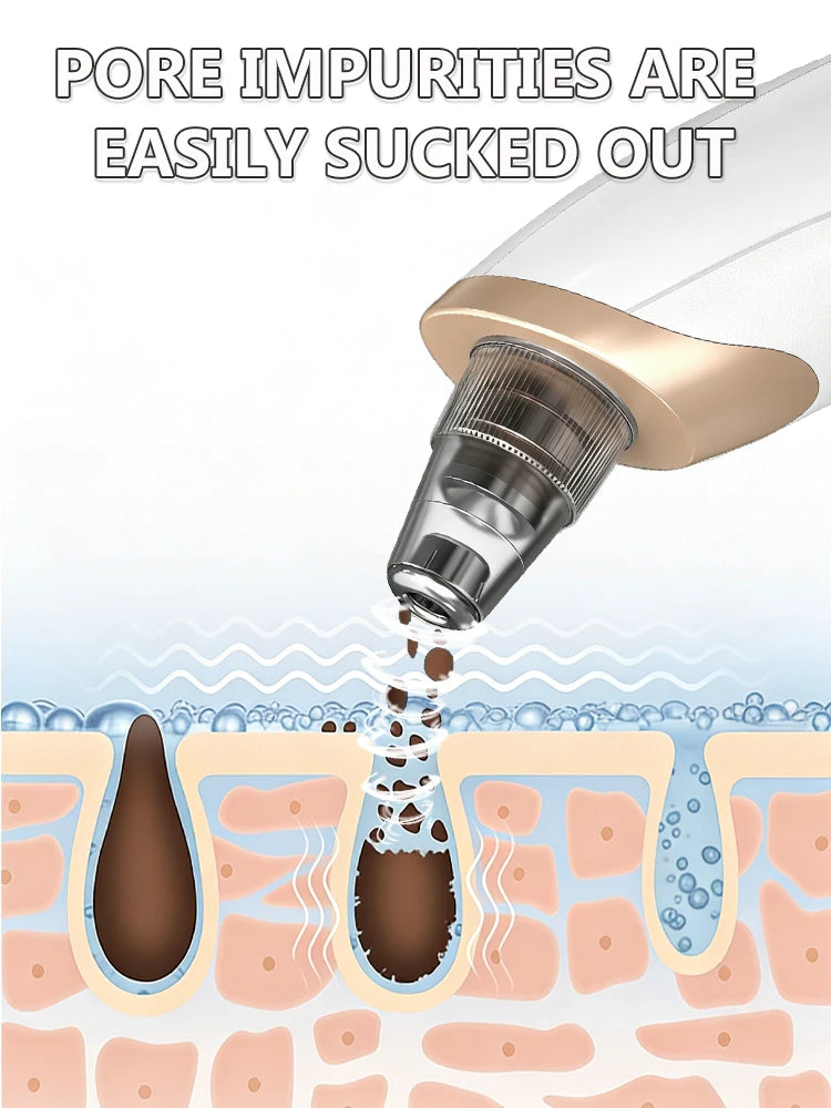 White and gold electric blackhead vacuum removing impurities from skin pores for facial acne and pore cleaning.
