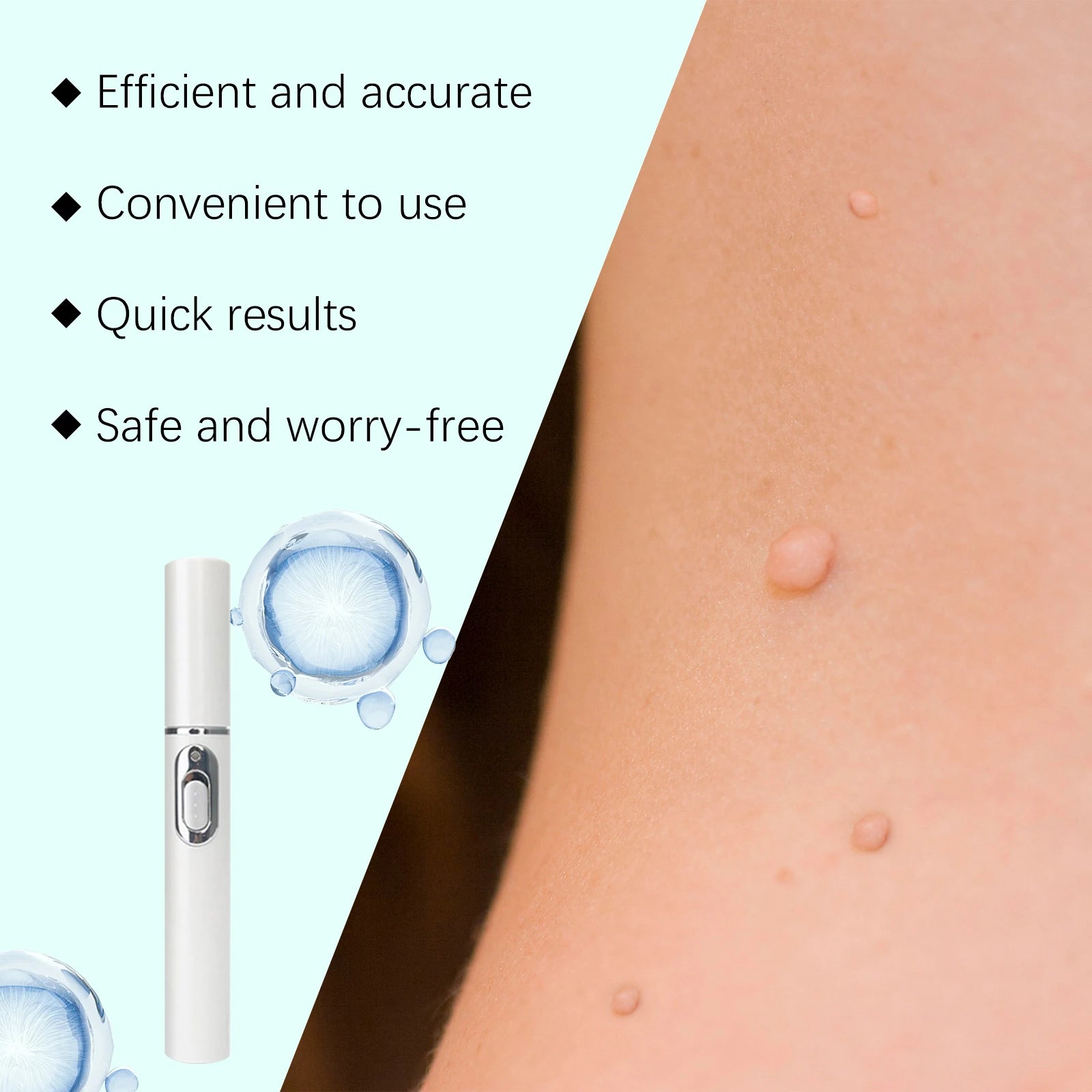 White pen-shaped skin tag removal device with a silver button, shown next to human skin with small skin growths.