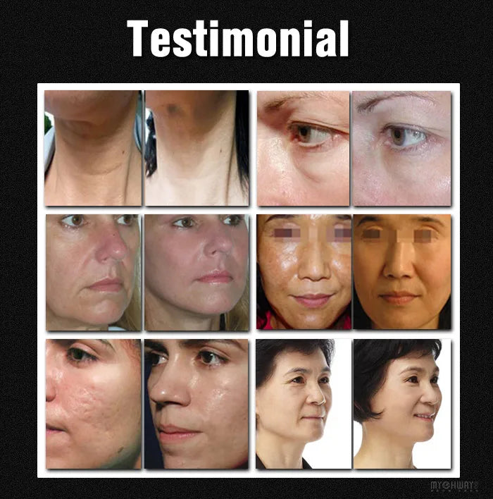 Before-and-after comparison grid showing skin improvements like reduced wrinkles, dark spots, and scarring.