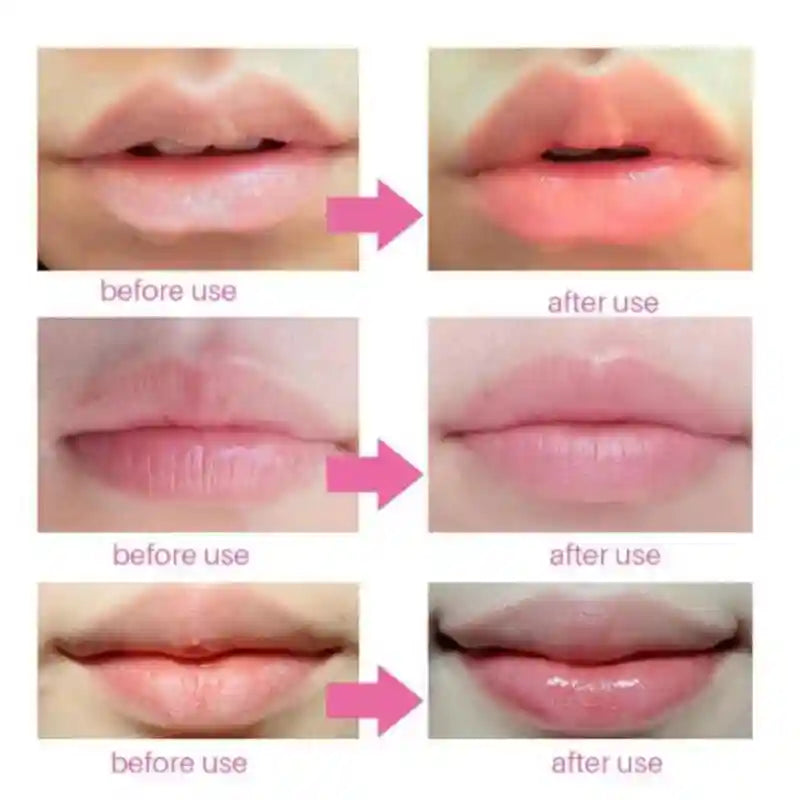 Cherry Collagen Lip Mask - Hydrating Lip Treatment (20 Pieces) Lip Care Tidesmit