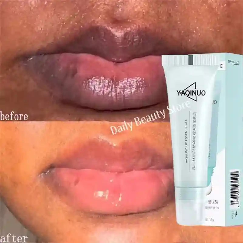 Dark Lip Lightening Balm - Moisturizing Exfoliator by Tidesmit Lip Care 1PCS Tidesmit