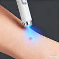 Handheld white blue light laser wart removal pen device treating a skin blemish on an arm.