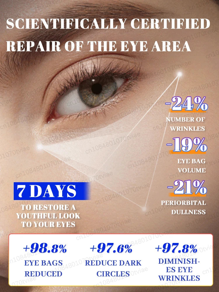 Dark Circle Eye Treatment: Portable Massager for Daily Stress Relief Relaxation Treatment Tidesmit