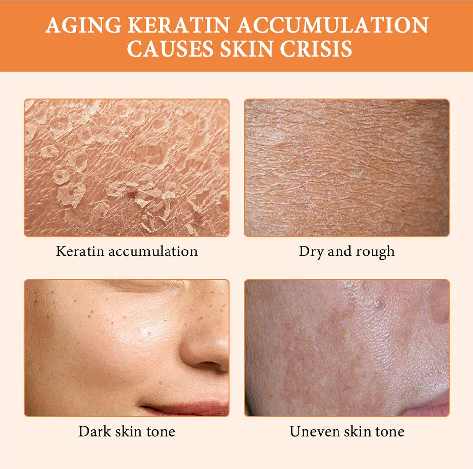 Orange Peeling Gel Body Exfoliator - Natural Deep Cleansing 50g Scrubs Treatments Tidesmit