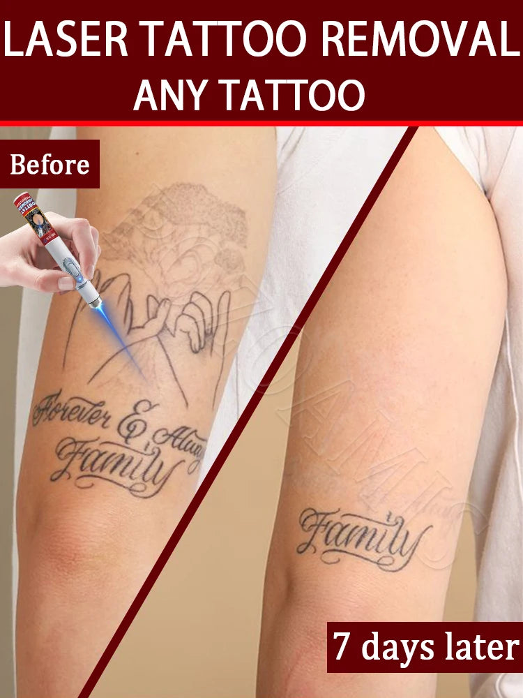 Nano Laser Tattoo Removal Pen for PMU and Pigmentation Treatment Permanent Makeup Machines Tidesmit